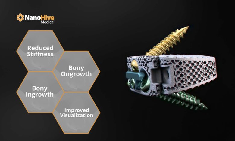 nanohive-medical-raises-7m-to-3d-print-spinal-surgery-devices NanoHive Medical Raises $7M to 3D Print Spinal Surgery Devices